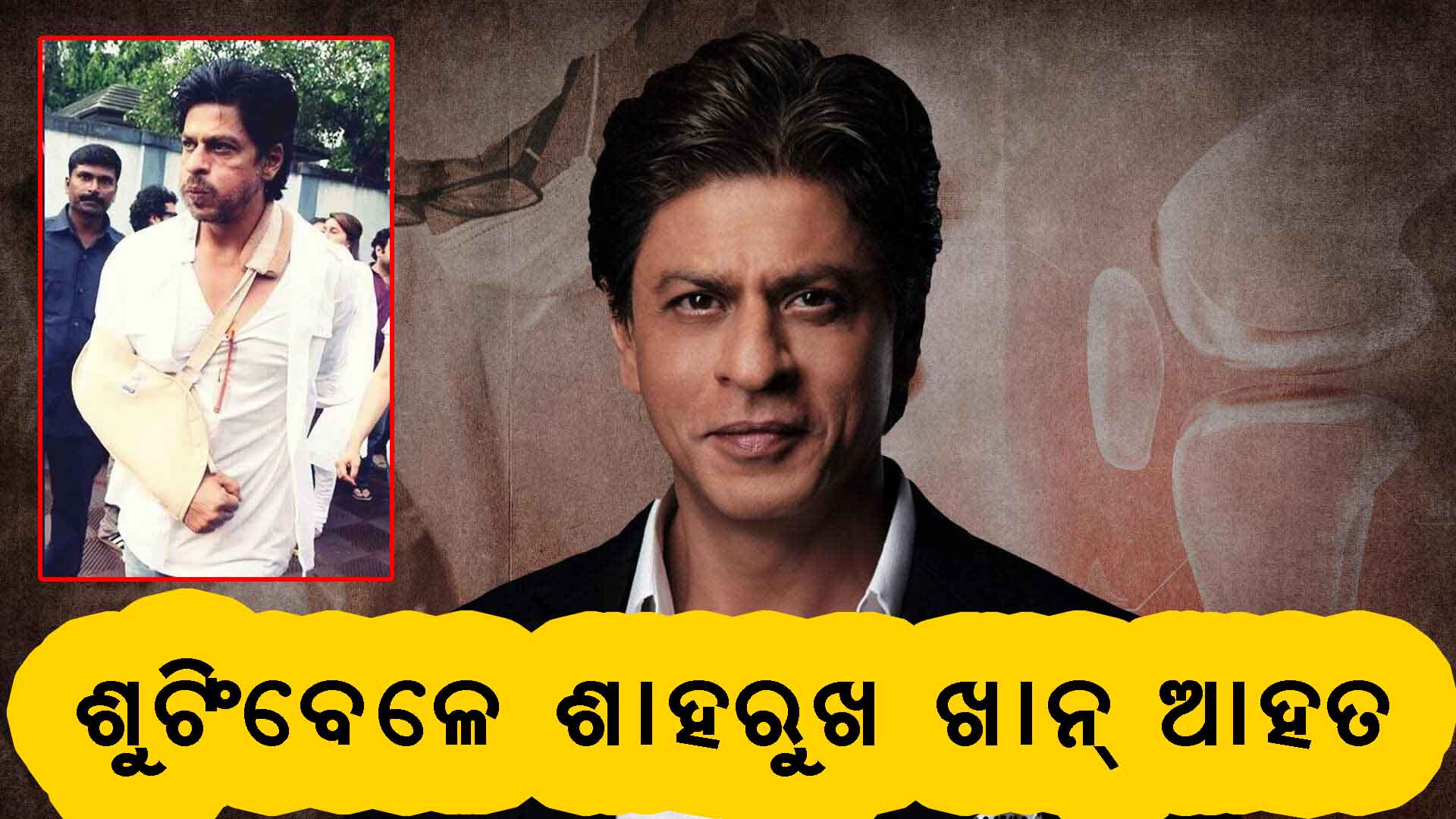 ଶାହରୁଖ ଖାନ୍ ଆଘାତ ଗ୍ରସ୍ତ ହେବା ପରେ ଚିକିତ୍ସାଧୀନ ଅବସ୍ଥାରେ ବ୍ରିଟେନରେ ଅଛନ୍ତି