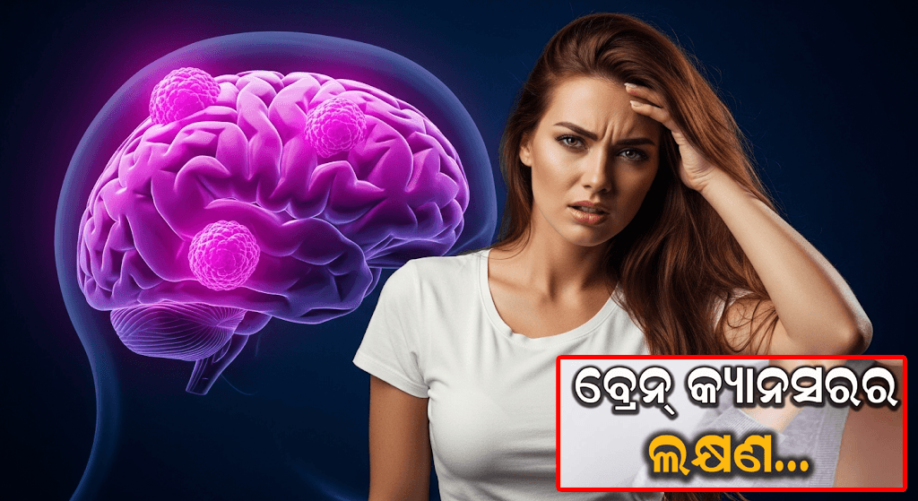 ମୁଣ୍ଡବ୍ୟଥାରେ ଆଖି ଚିପୁଡ଼ୁଥିବା ଚିତ୍ର: ବ୍ରେନ୍ କ୍ୟାନସରର ପ୍ରମୁଖ ଲକ୍ଷଣ